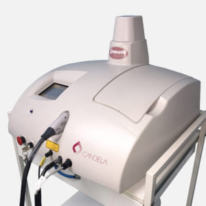 Candela SmoothBeam Acne Laser | Medshare Laser